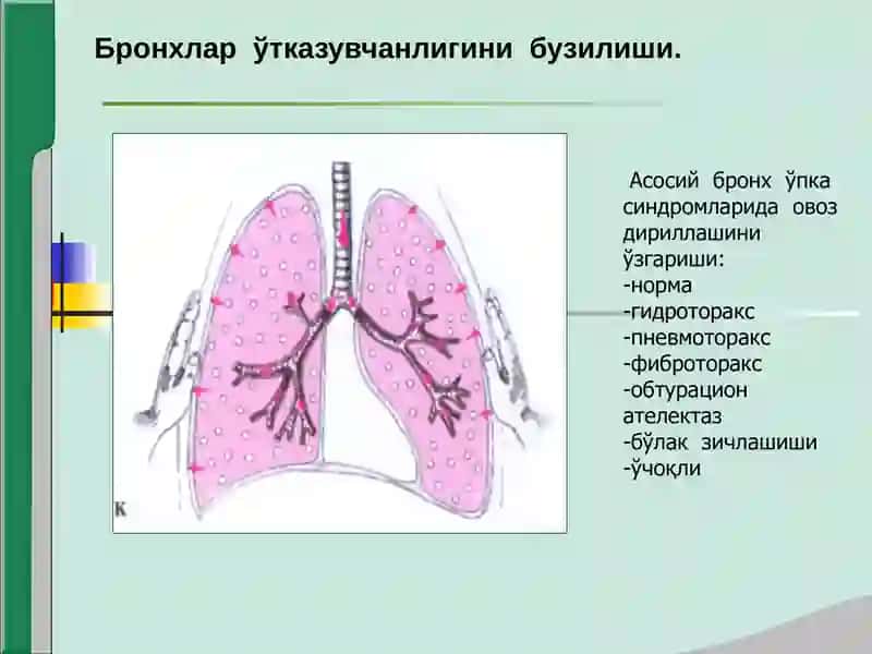 Нафас органлари касалликларида асосий клиник синдромлар 4