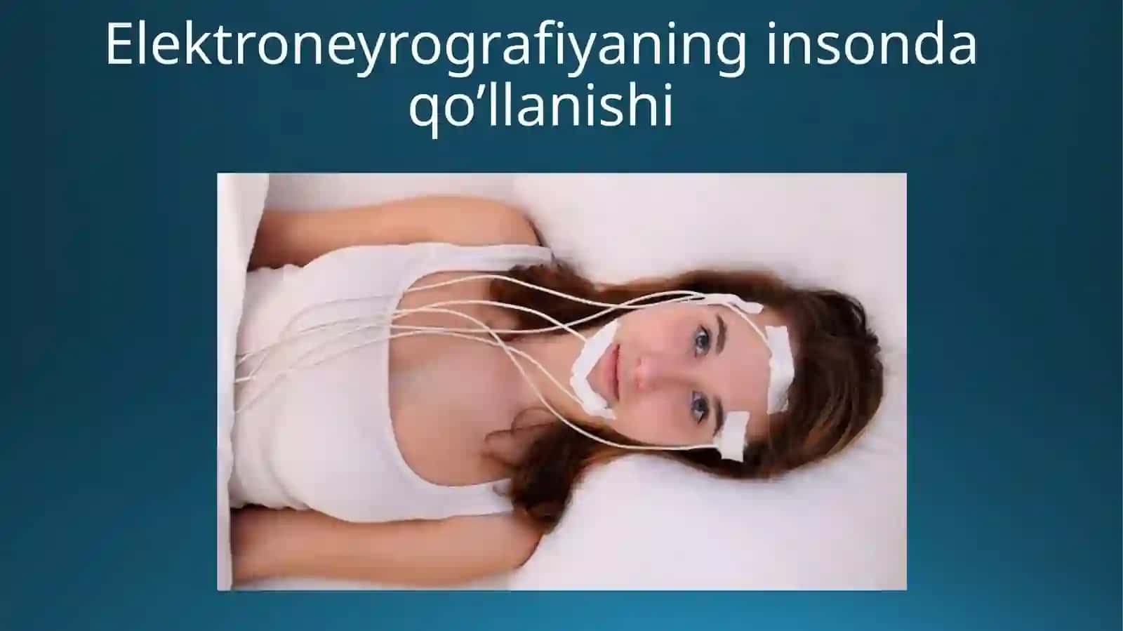 Elektroneyrografiya 4