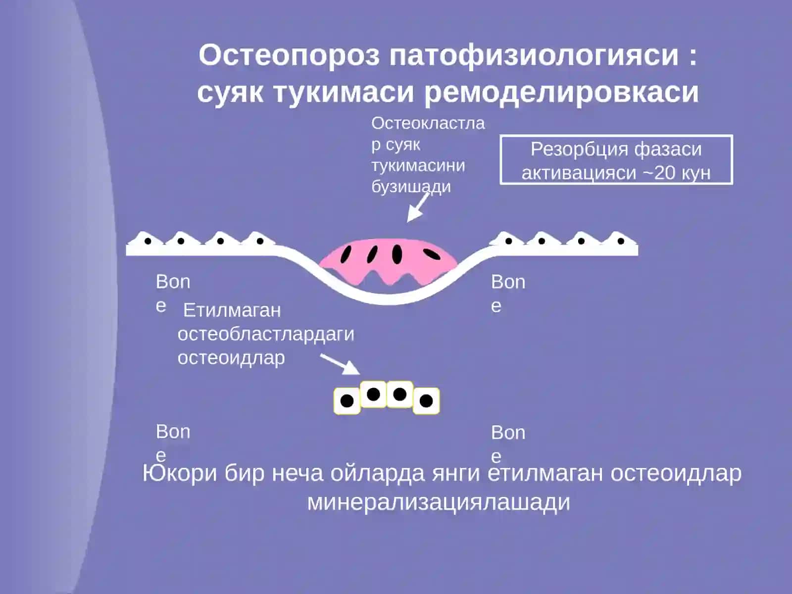 Остеопороз 4