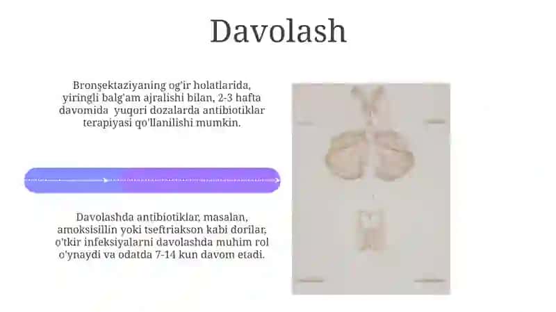 Bronxiektaziya kasalligi 4