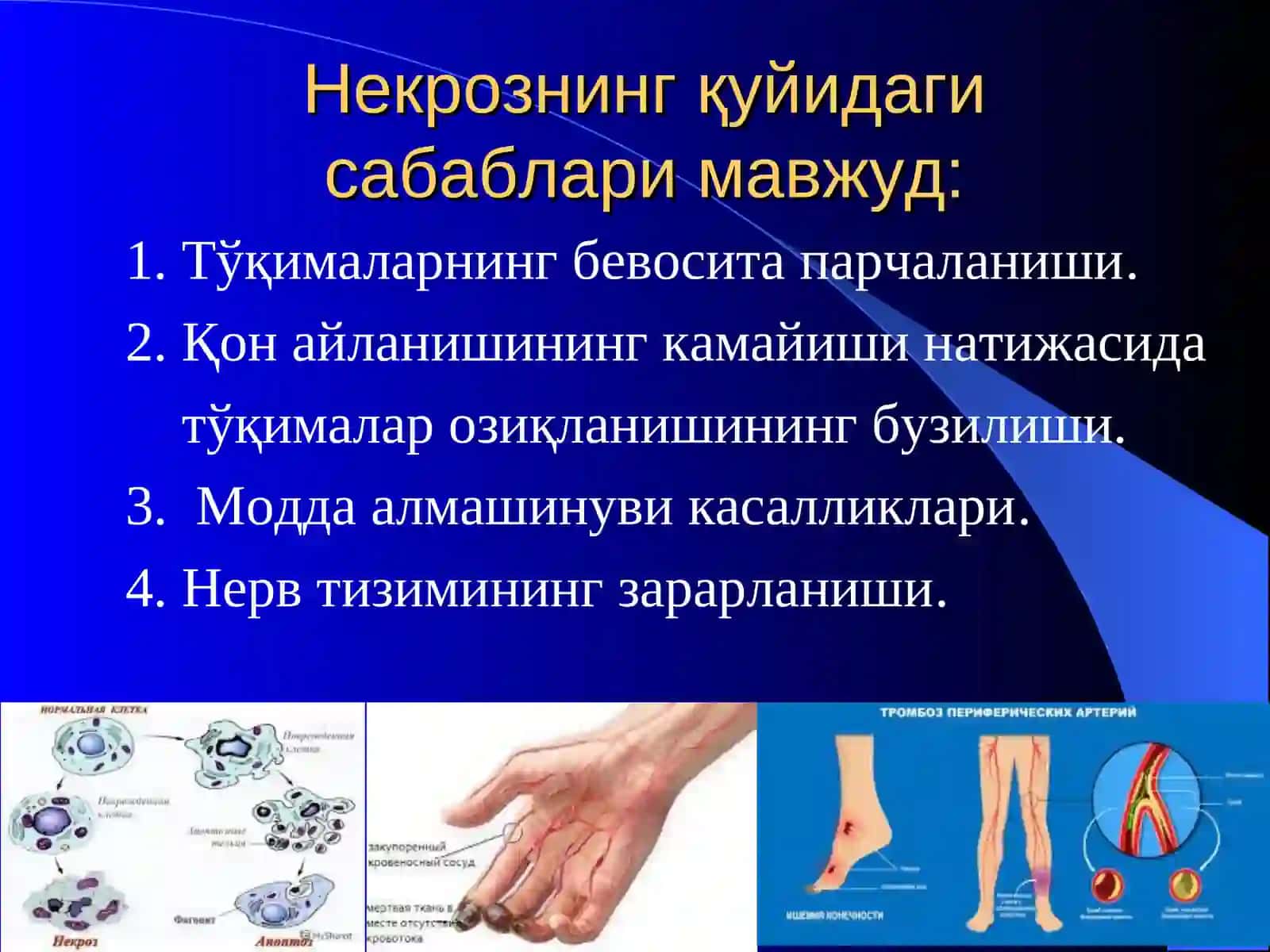 Некрозлар, гангреналар ва оқма яралар 4