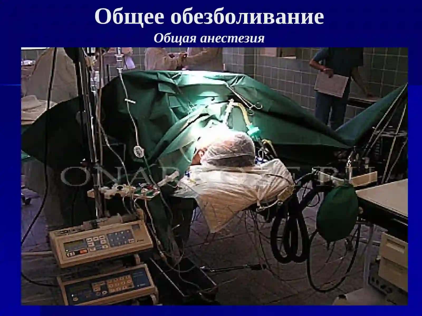 Общая анестезия 4