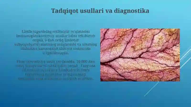 Limfatik tugunning retikulyar toqimasi 4