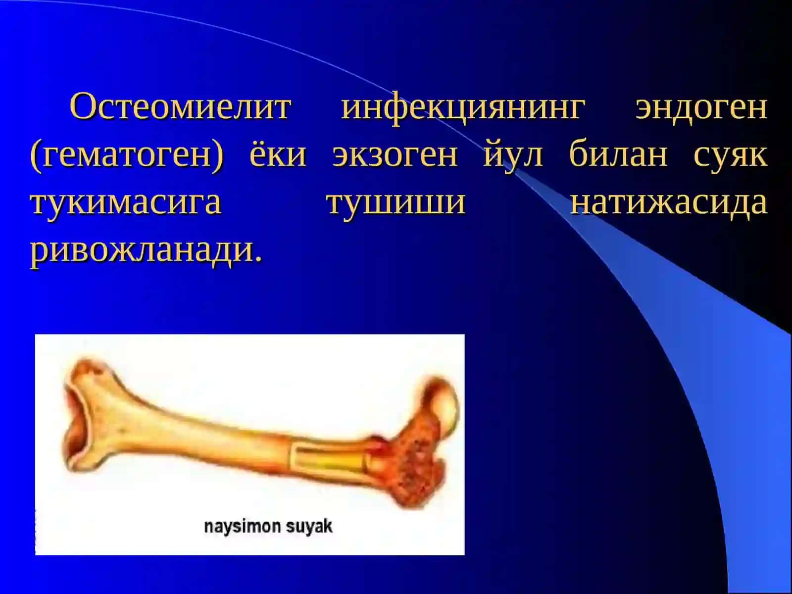 «Остеомиелит, артрит, бурсит» 4