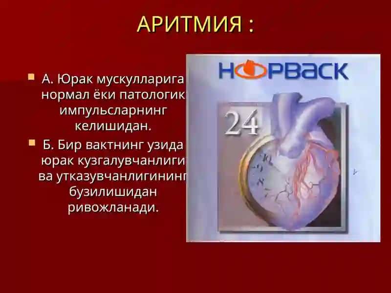 Аритмияга карши дори воситалар 4