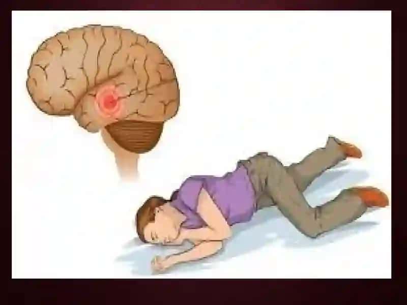 Epilepsiyaga qarshi vositalar 4