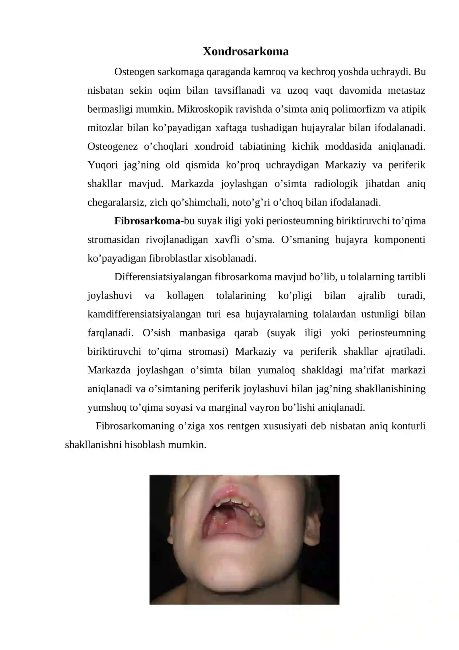 Jag’ning xavfli o’smalari 4