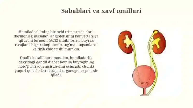 Tug'ma buyrak nuqsonlari 4