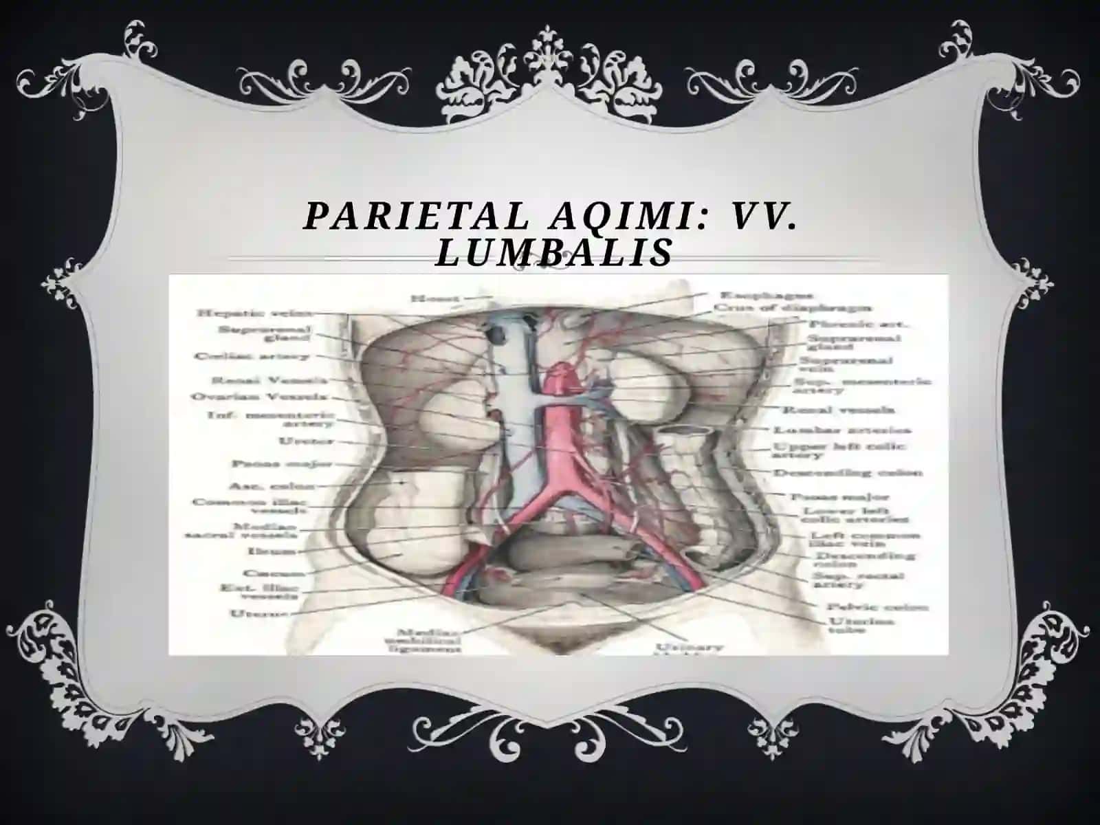 VENA CAVA INFERIOR 4