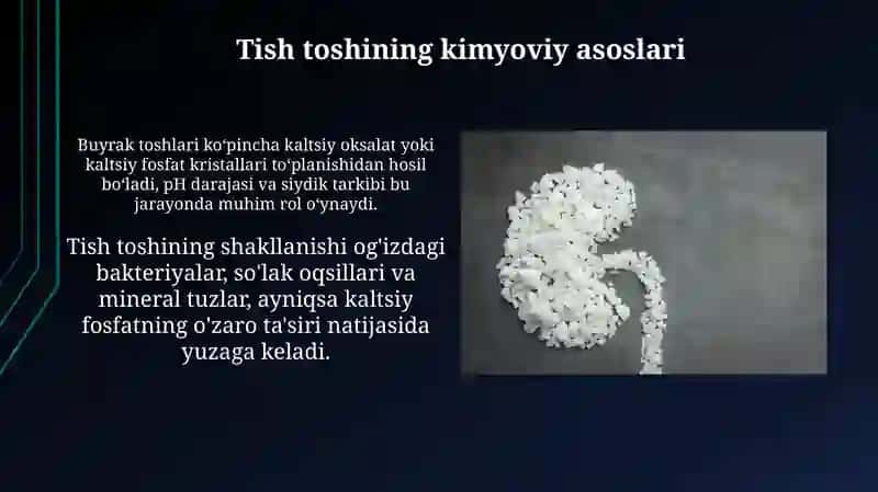 Buyrak toshi kasalligining kimyoviy asoslari 4