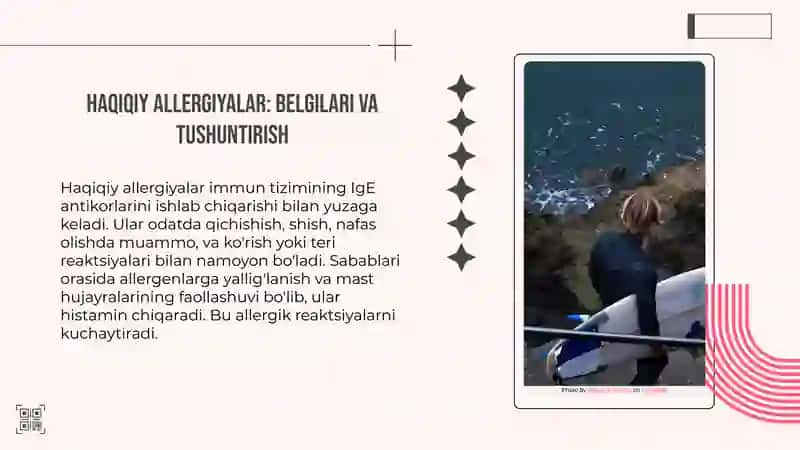 Ovqat allergiyasi 4