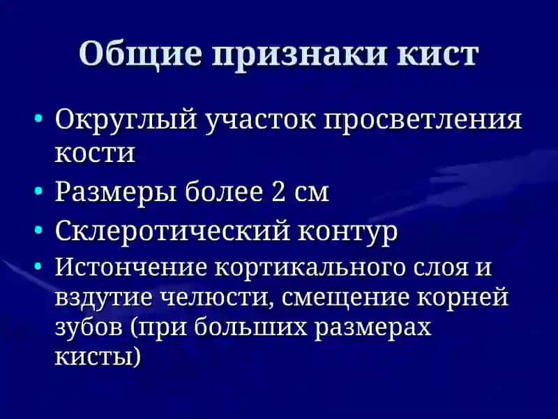 Кисты и опухоли ЧЛО 4