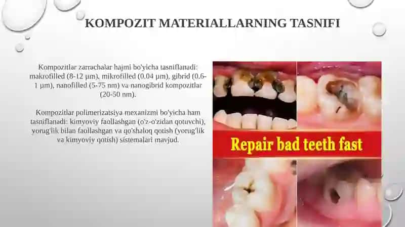 Kompozit materiallar 4