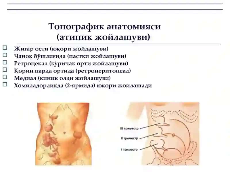 Ўткир аппендицит ва унинг асоратлари 4