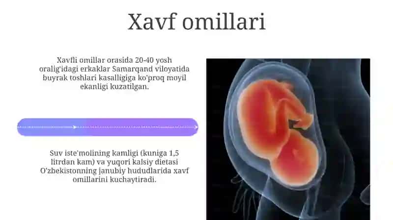 Buyrak va siydiktosh kasalliklari 4
