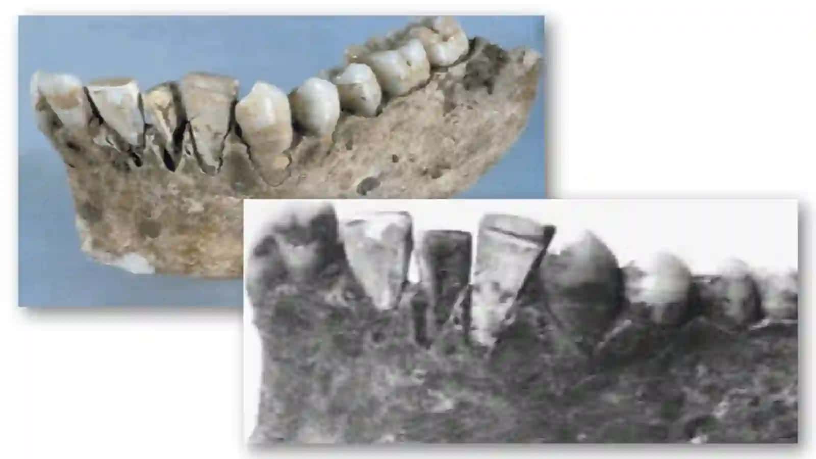Dental implantologiya 4