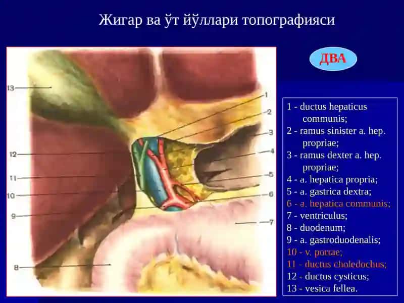 Ўткир Холецистит ва унинг асоратлари 4