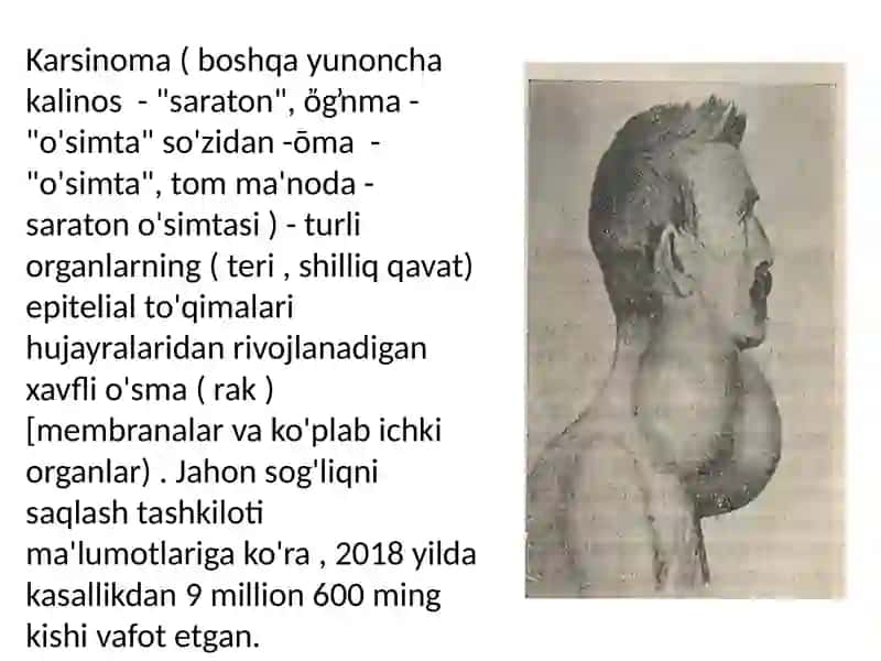 Terikasalliklar 4