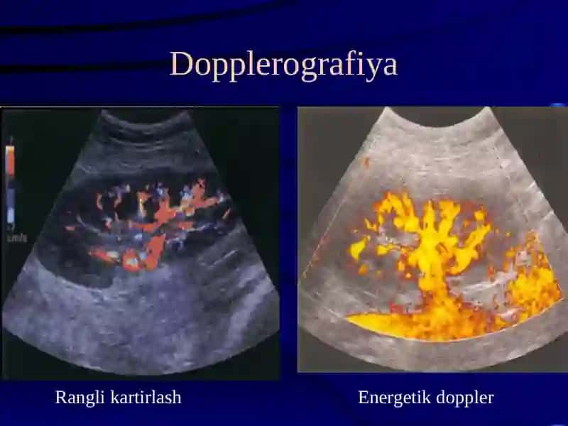 siydiq yo'llari kasalliklarining nur diagnostikasi 4