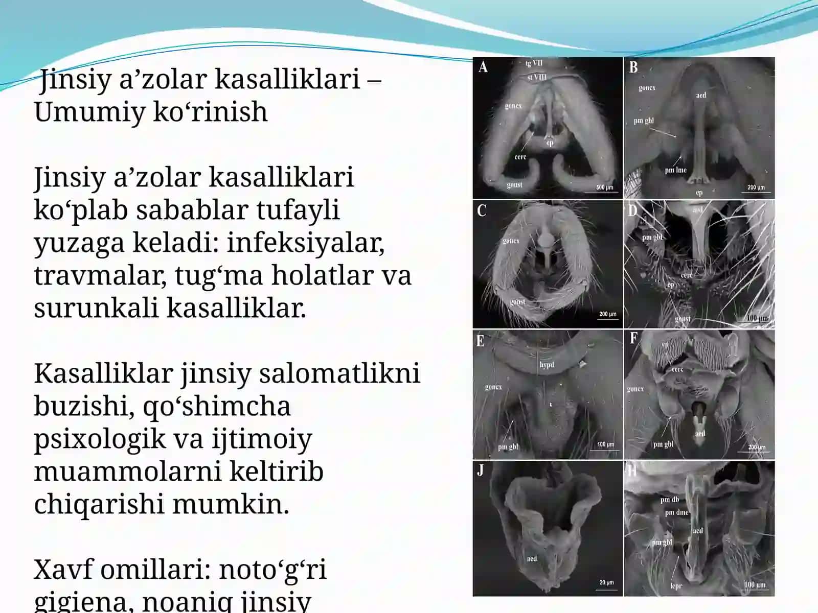 Erkaklar jinsiya zolar va uretra kasalliklari 4