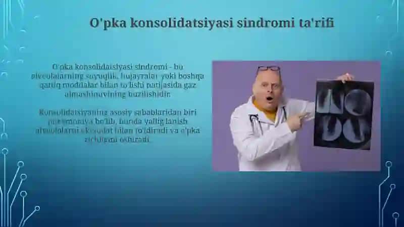 O'pka to'qimasini zichlashish sindromi 4