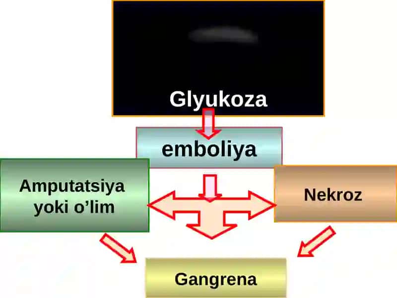 Қандли диабет 4
