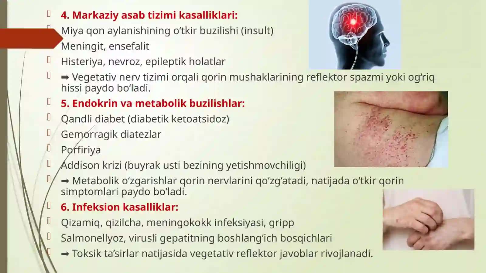 O’TKIR QORINNI STIMULLOVCHI KASALLIKLAR 4
