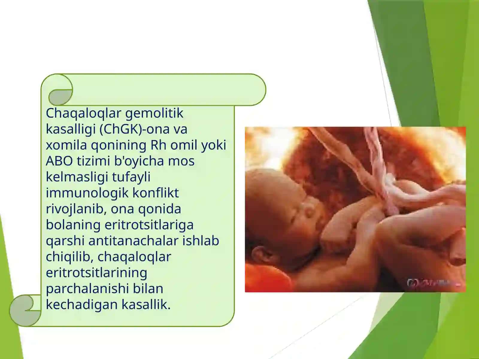 Chaqaloqlar gemolitik kasalligi 4