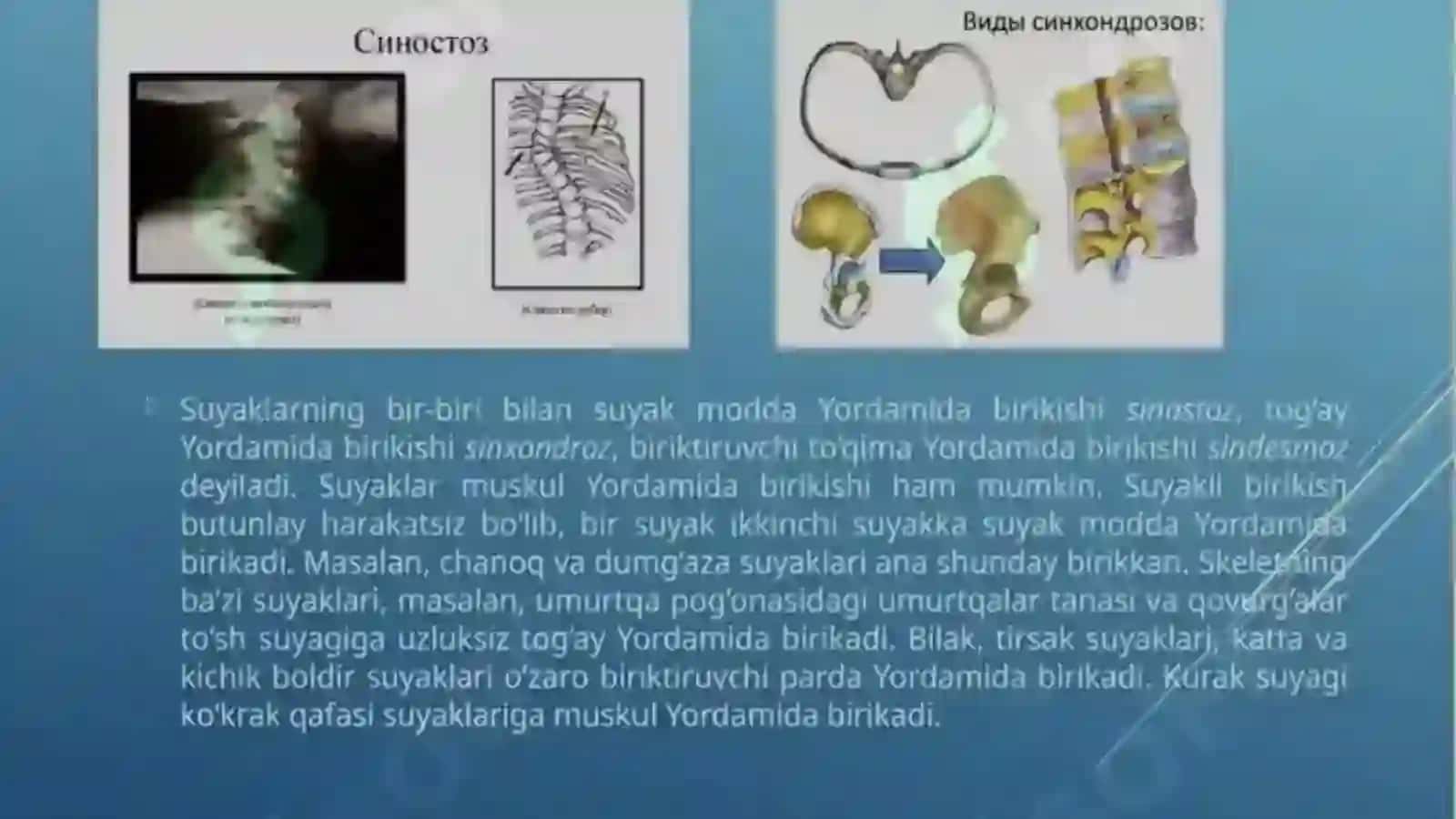 Sindesmoz, sinxondroz,sinostoz birlashuvlar 4