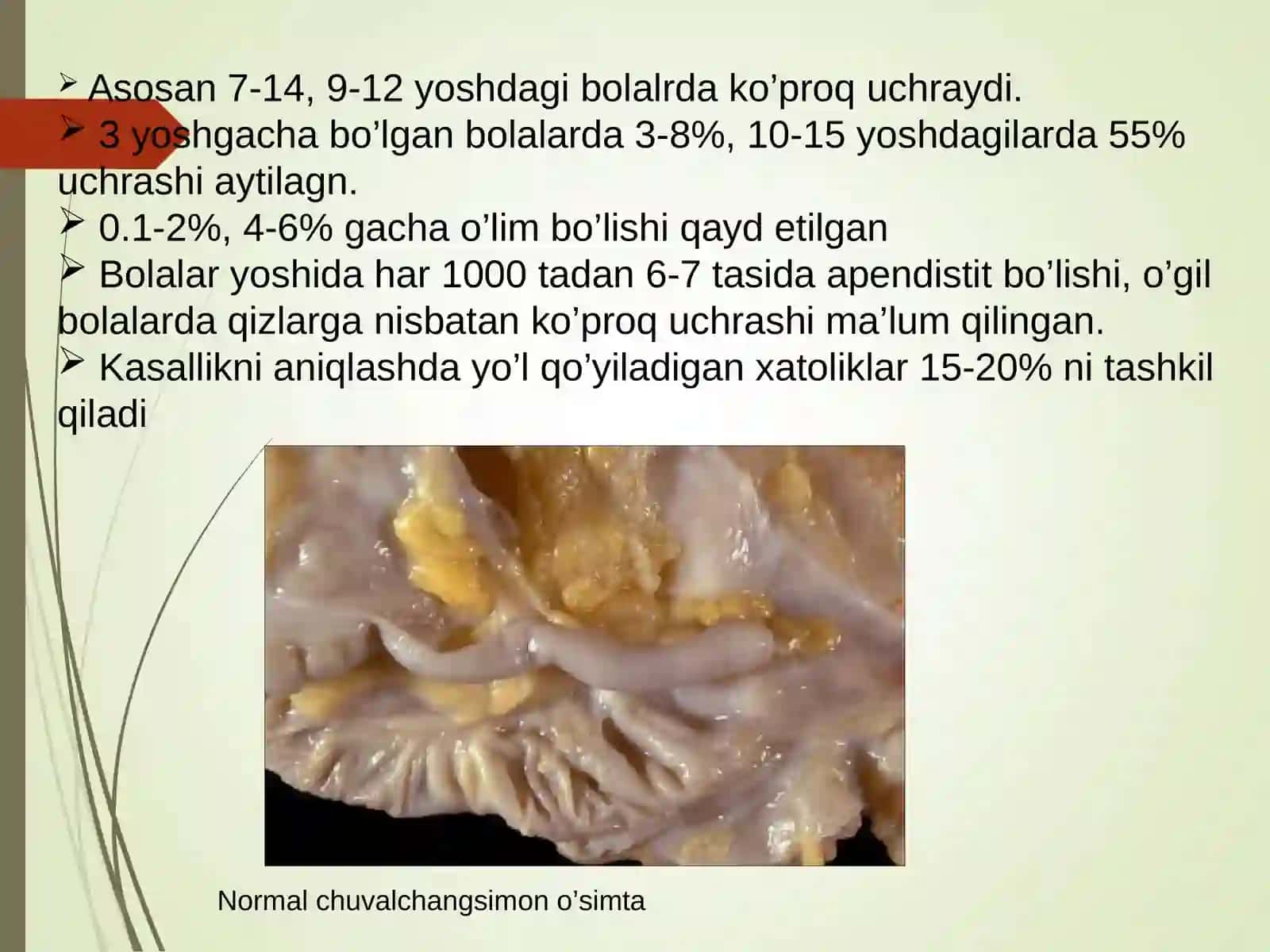 3 yoshgacha bo’lgan bolalarda O`tkir appenditsit 4