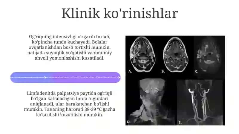 Bolalar jarrohlik stomatologiyasi 1-kurs 4