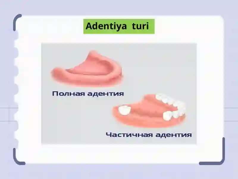 Terapevtik stomatologiya 4
