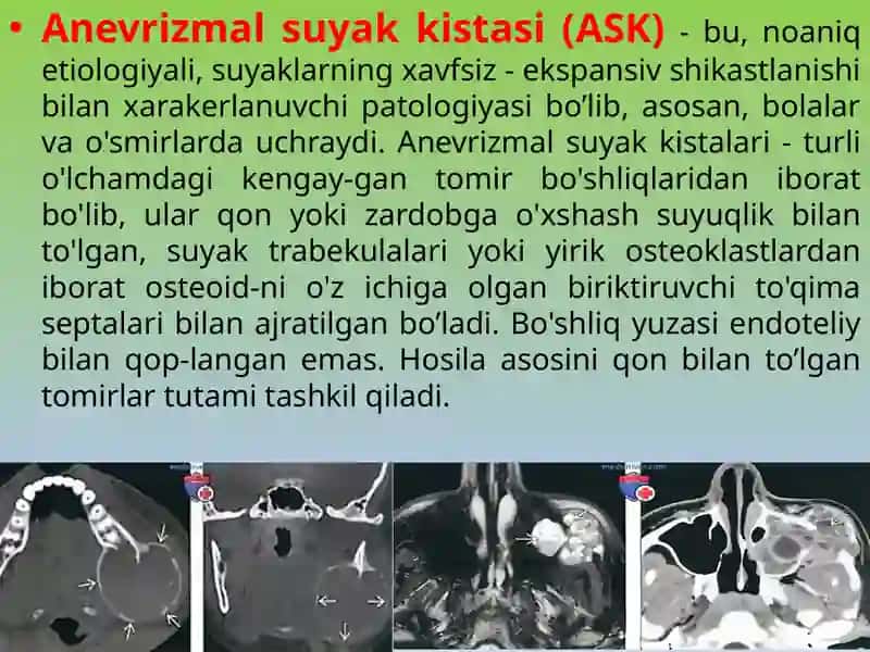 SUYAK KISTALARI 4