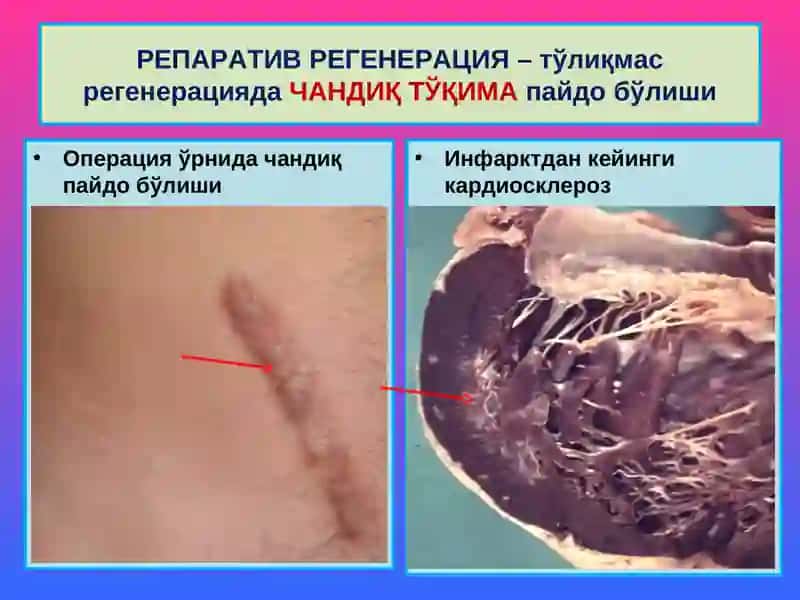МОСЛАНИШ-ЎРИН АЛМАШИНИШ ЖАРАЁНЛАРИ 4