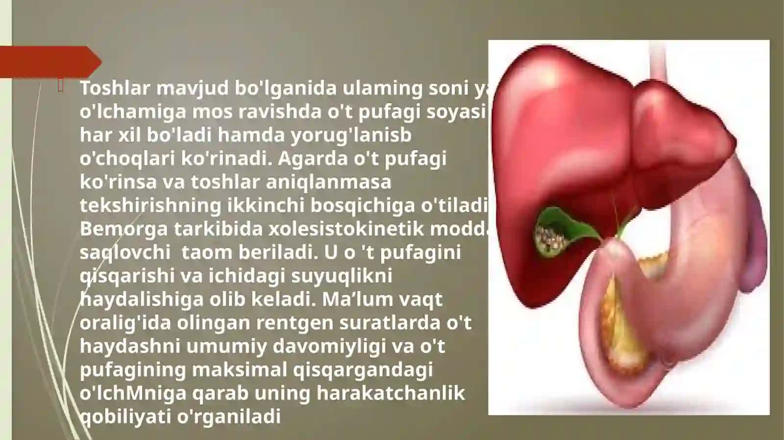 Xolisistografiya 4