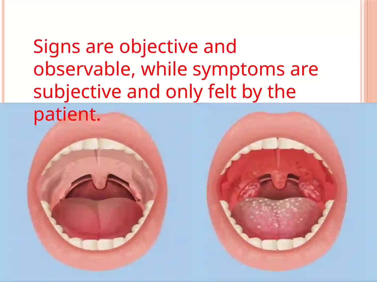 DIFFERENCES BETWEEN SIGNS AND SYMPTOMS 4