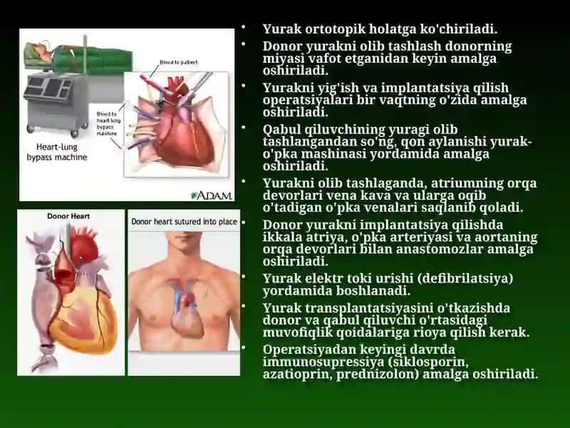 TRANSPLANTATSIYA 4