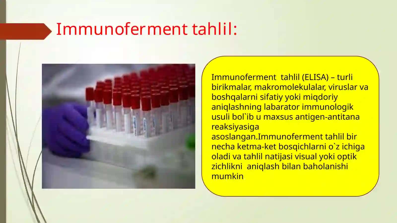Serologik tekshiruvning immunoferment tahlil usullari 4