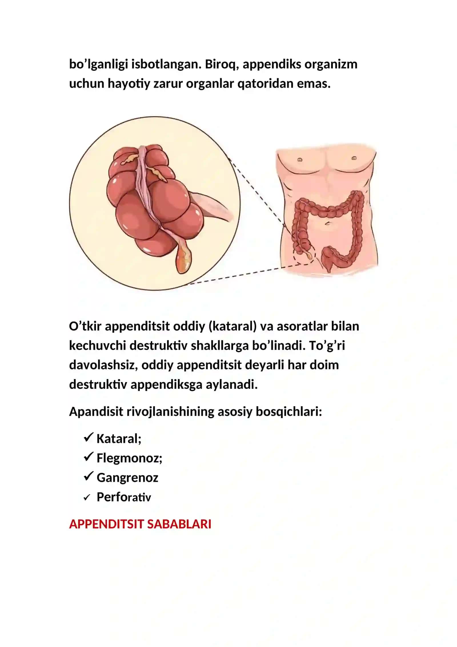 APPENDITSIT — TA’RIFI, TASNIFI, BELGILARI VA ALOMATLARI, TASHXISLASH VA DAVOLASH 4