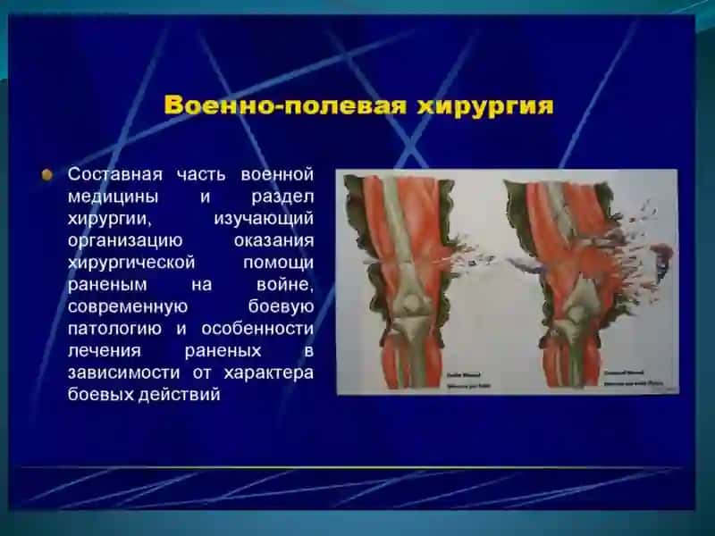 Военно-полевая хирургия 4