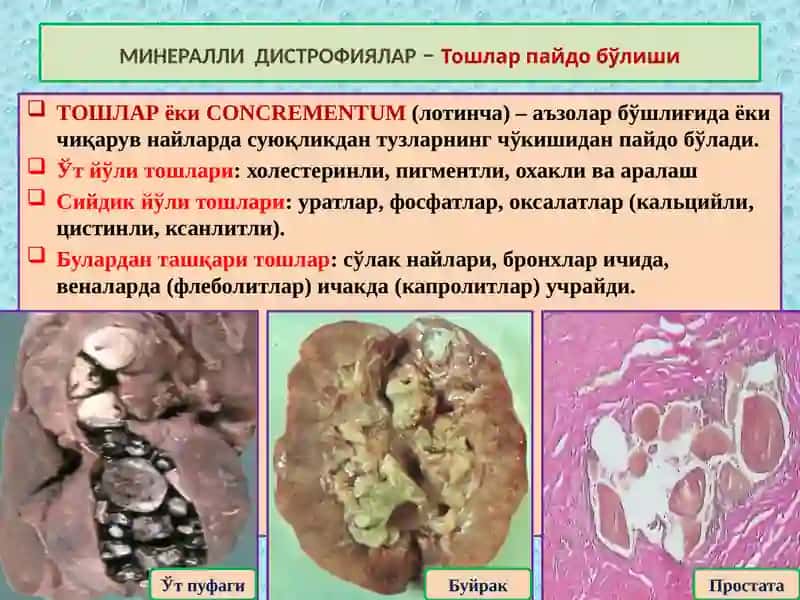 МИНЕРАЛЛИ ДИСТРОФИЯЛАР 4