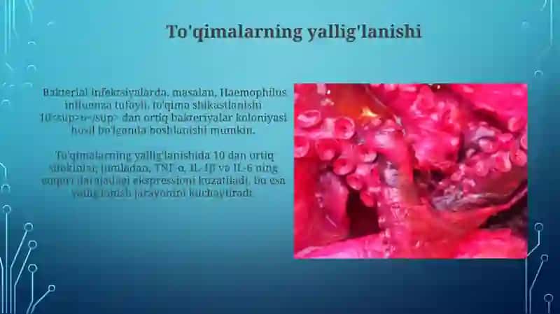 Bronhit kasalligi va Gemofil qo'zg'atuvchilari, patogenez va laboratoriya tashhisi 4
