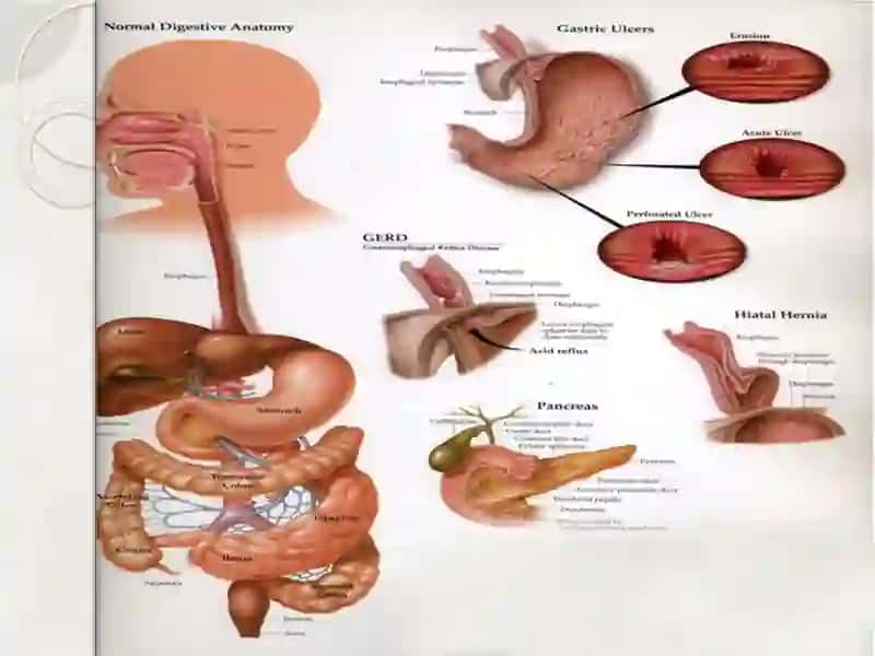 Гастритлар 4