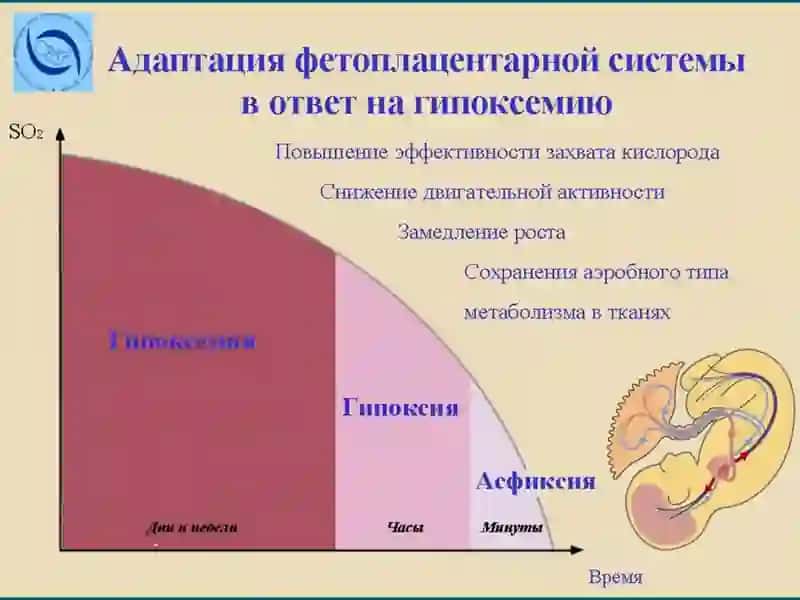 Асфиксия новорожденных 4