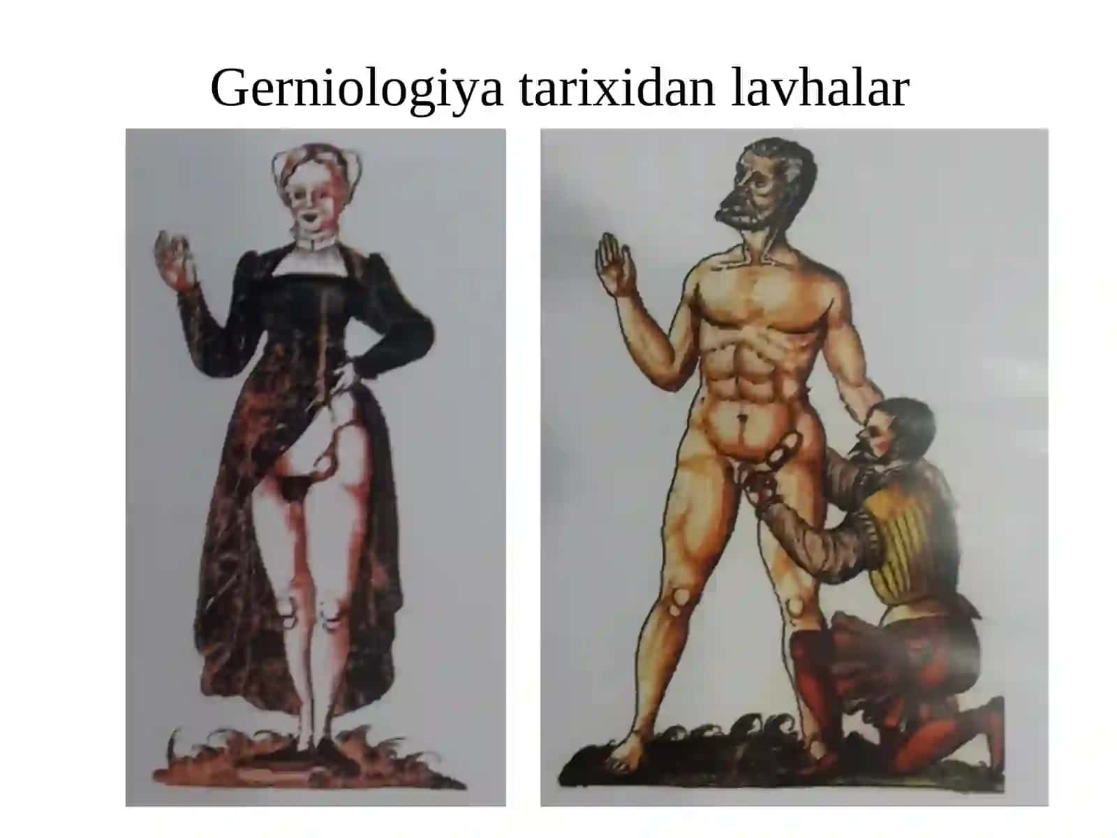 Qorin churralari va uning asoratlari 4