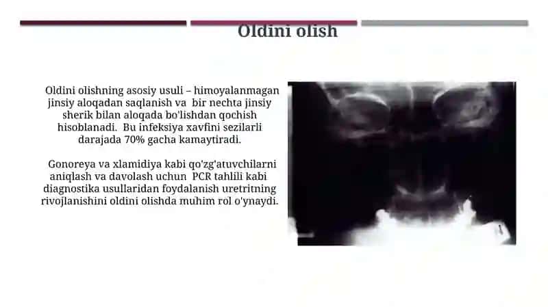 So'zak va So'zaksiz uretritlar 4