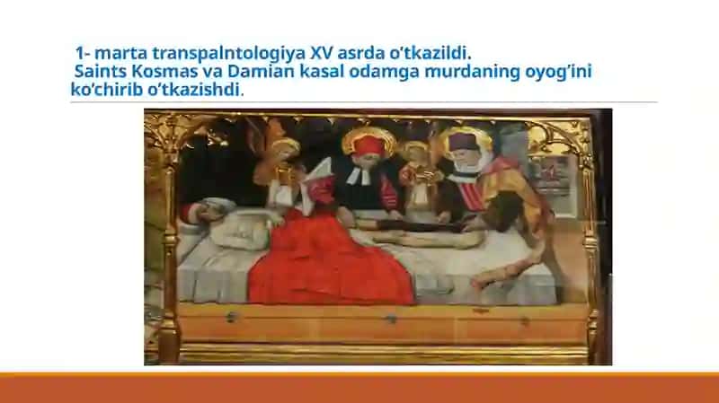 Transplantologiya va uning rivojlanishi tarixi 4