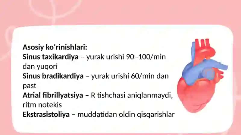 EKG yozuvi dagi asosiy klinik sindromlarni aniqlash. Ular asosida xulosa yozish 4