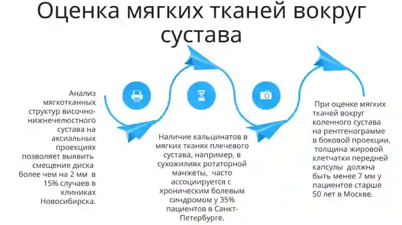 Рентгеноанатомия суставов 4