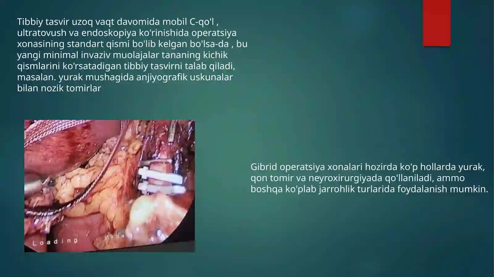 Gibrid operatsiyalar 4